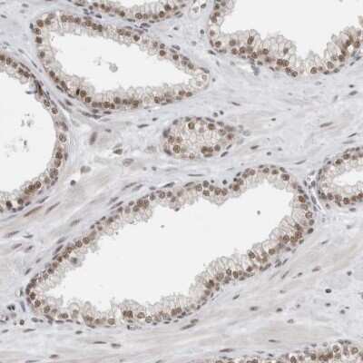 Immunohistochemistry-Paraffin: NCAPG2 Antibody [NBP1-86633]