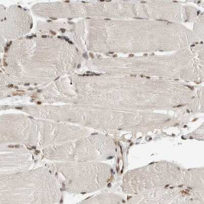 Immunohistochemistry-Paraffin: NCAPG2 Antibody [NBP1-86633]