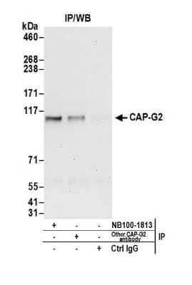 Immunoprecipitation: NCAPG2 Antibody [NB100-1813]