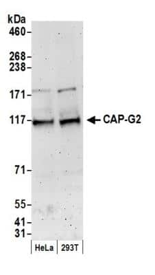 Western Blot: NCAPG2 Antibody [NB100-1813]