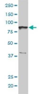 Western Blot: NCAPH Antibody (1C9) [H00023397-M01]