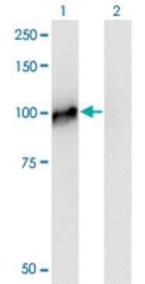Western Blot: NCAPH Antibody (1C9) [H00023397-M01]