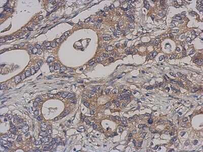 Immunohistochemistry-Paraffin: NCAPH Antibody [NBP1-32573]