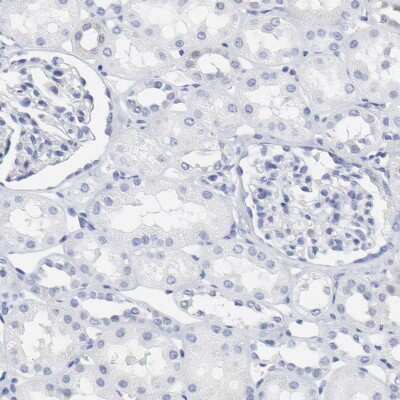 Immunohistochemistry-Paraffin: NCAPH Antibody [NBP1-88345]