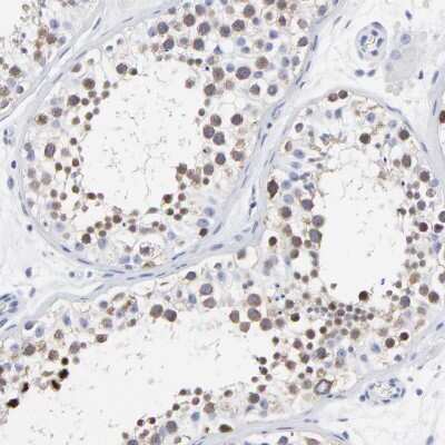 Immunohistochemistry-Paraffin: NCAPH Antibody [NBP1-88345]