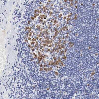 Immunohistochemistry-Paraffin: NCAPH Antibody [NBP1-88345]
