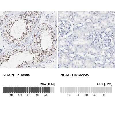 Immunohistochemistry-Paraffin: NCAPH Antibody [NBP1-88345]