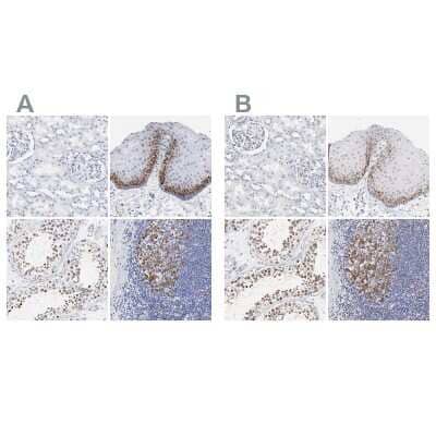 Immunohistochemistry-Paraffin: NCAPH Antibody [NBP1-88345]