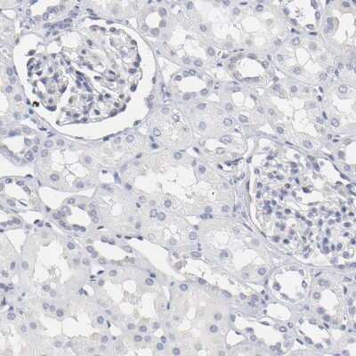 Immunohistochemistry-Paraffin: NCAPH Antibody [NBP1-88346]