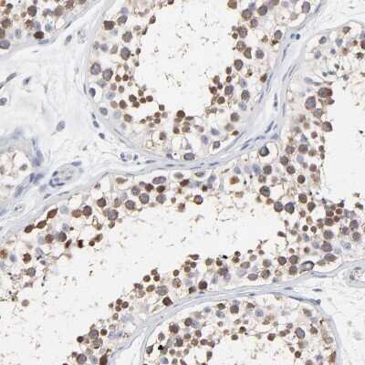 Immunohistochemistry-Paraffin: NCAPH Antibody [NBP1-88346]