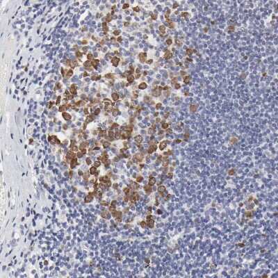 Immunohistochemistry-Paraffin: NCAPH Antibody [NBP1-88346]