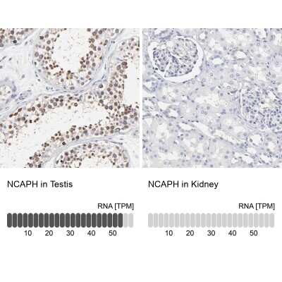Immunohistochemistry-Paraffin: NCAPH Antibody [NBP1-88346]