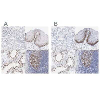 Immunohistochemistry-Paraffin: NCAPH Antibody [NBP1-88346]