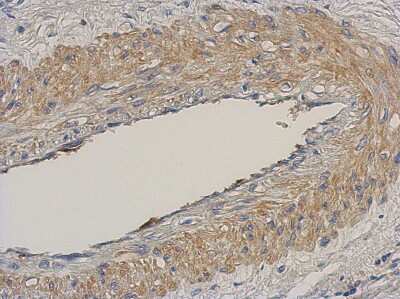 Immunohistochemistry-Paraffin: NCAPH Antibody [NBP2-19483]