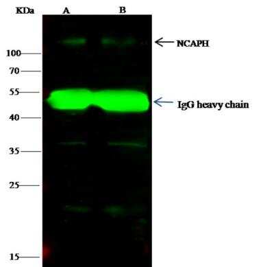 Immunoprecipitation: NCAPH Antibody [NBP2-98781]