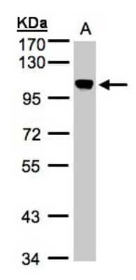 Western Blot: NCAPH Antibody [NBP1-32573]