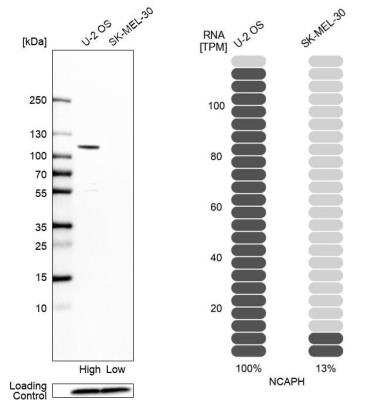 Western Blot: NCAPH Antibody [NBP1-88346]