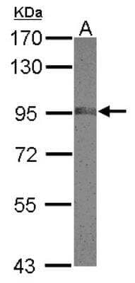 Western Blot: NCAPH Antibody [NBP2-19483]