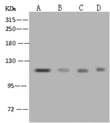 Western Blot: NCAPH Antibody [NBP2-97603]