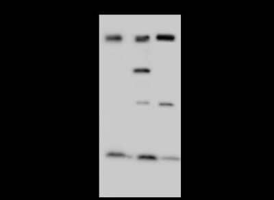 Western Blot: NCAPH Antibody [NBP2-98779]