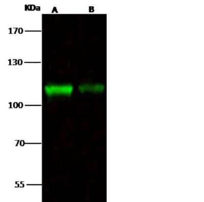 Western Blot: NCAPH Antibody [NBP2-98781]