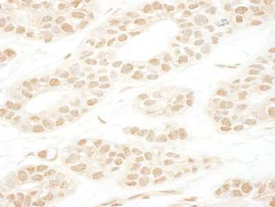 Immunohistochemistry: NCAPH2 Antibody [NBP1-28723]