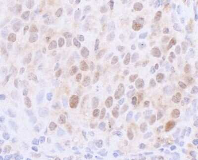 Immunohistochemistry: NCAPH2 Antibody [NBP1-28723]