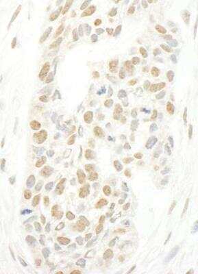 Immunohistochemistry-Paraffin: NCAPH2 Antibody [NBP1-28723]