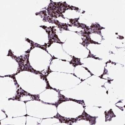 Immunohistochemistry-Paraffin: NCAPH2 Antibody [NBP2-49580]