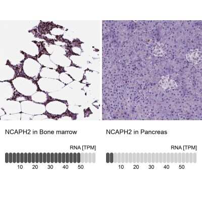 Immunohistochemistry-Paraffin: NCAPH2 Antibody [NBP2-49580]