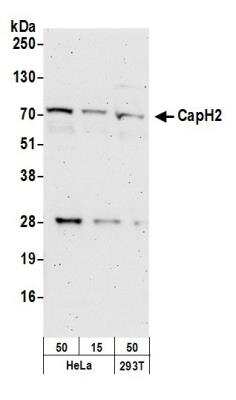 Western Blot: NCAPH2 Antibody [NBP1-28723]