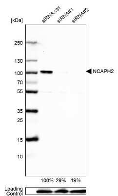 Western Blot: NCAPH2 Antibody [NBP2-49580]