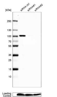 Western Blot: NCAPH2 Antibody [NBP2-57498]