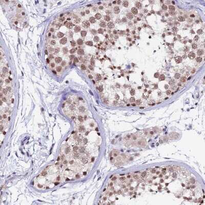 Immunohistochemistry-Paraffin: NCBP1 Antibody [NBP2-33897]
