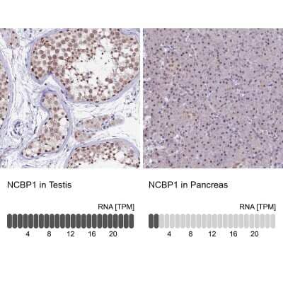 Immunohistochemistry-Paraffin: NCBP1 Antibody [NBP2-33897]