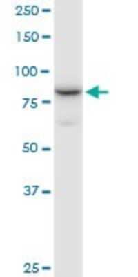 Western Blot: NCBP1 Antibody [H00004686-B01P]