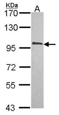 Western Blot: NCBP1 Antibody [NBP2-19484]