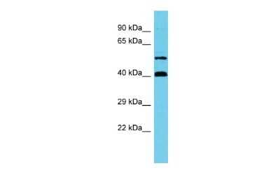 Western Blot: NCBP3 Antibody [NBP2-87884]