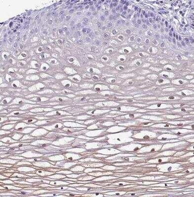 Immunohistochemistry-Paraffin: NCCRP1 Antibody [NBP2-13642]