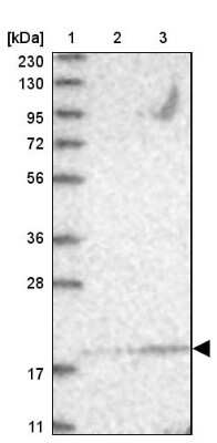 Western Blot: UBE2F/NCE2 Antibody [NBP1-92169]