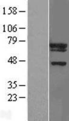 Western Blot: UBE2F/NCE2 Overexpression Lysate [NBP2-05766]