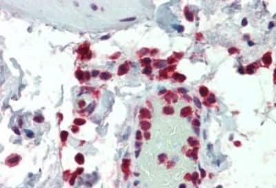 Immunohistochemistry-Paraffin: NCF1 Antibody [NB100-790]