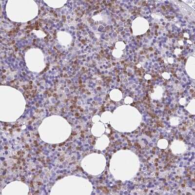 Immunohistochemistry-Paraffin: NCF1 Antibody [NBP2-33502]