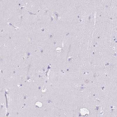 Immunohistochemistry-Paraffin: NCF1 Antibody [NBP2-33502]