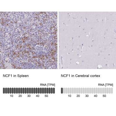 Immunohistochemistry-Paraffin: NCF1 Antibody [NBP2-33502]