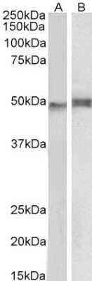 Western Blot: NCF1 Antibody [NB100-790]