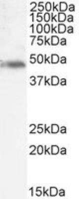 Western Blot: NCF1 Antibody [NBP2-26113]