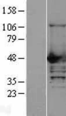 Western Blot: NCF1 Overexpression Lysate [NBL1-13509]