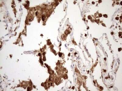 Immunohistochemistry: NCF4 Antibody (OTI4B5) [NBP2-46111]