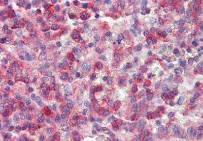 Immunohistochemistry-Paraffin: NCF4 Antibody [NB100-61666]